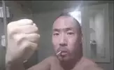 원영탈모